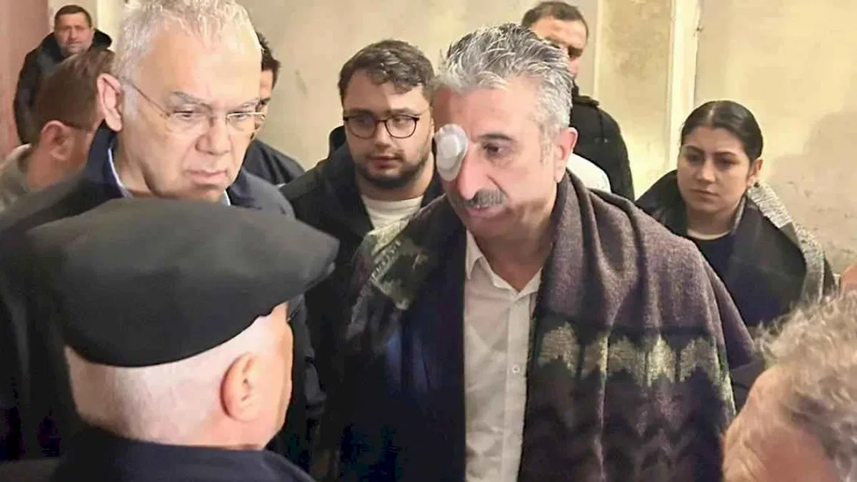 Bursa'daki eylemlerde CHP İl Başkanı yaralandı! Gözaltılar var