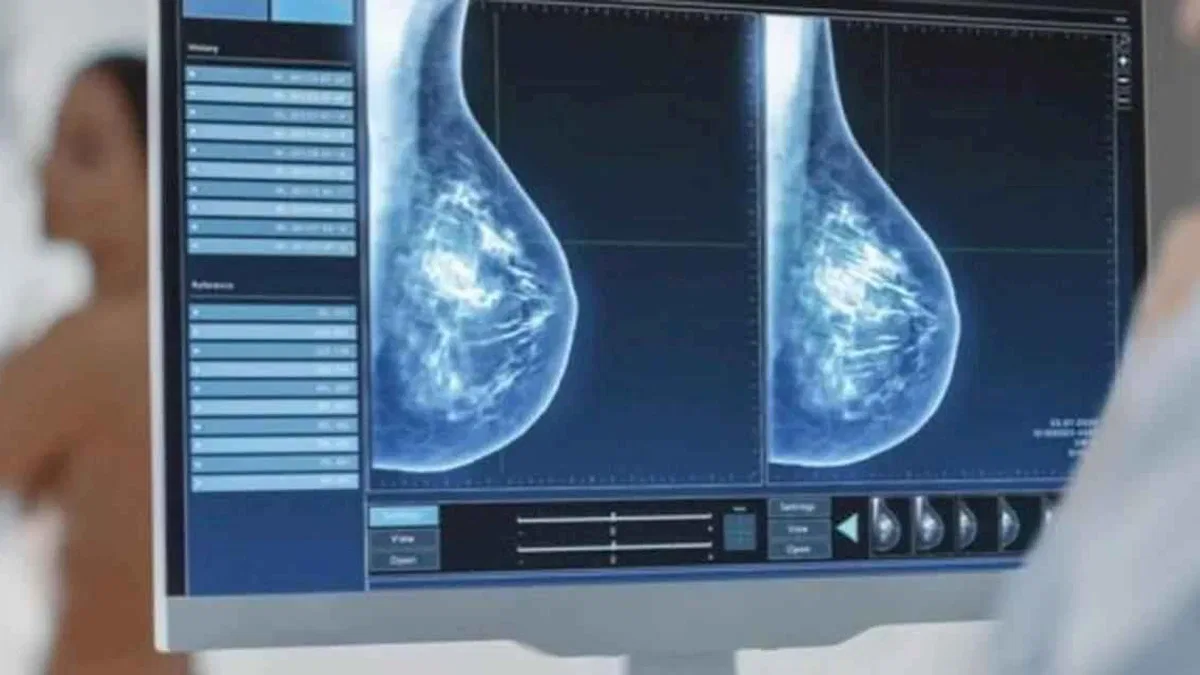 Kötü haber korkusu mamografi taramasına engel!