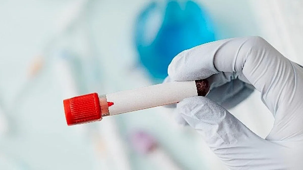 Sepsis: Vücudun Sessiz Fırtınası