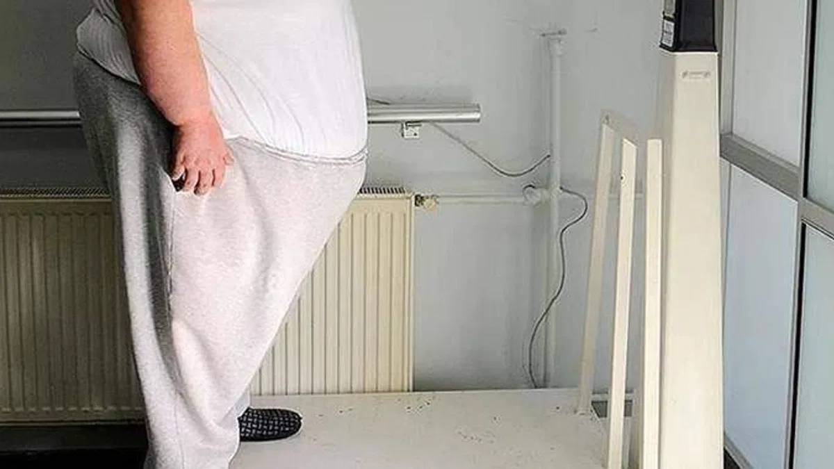 Türkiye'de obezite görülme sıklığı artıyor