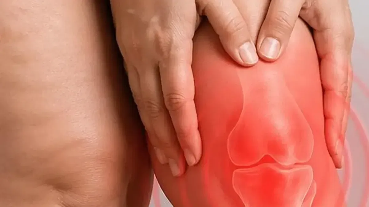 Diz biyomekaniğini bozan süreç: Lipödem