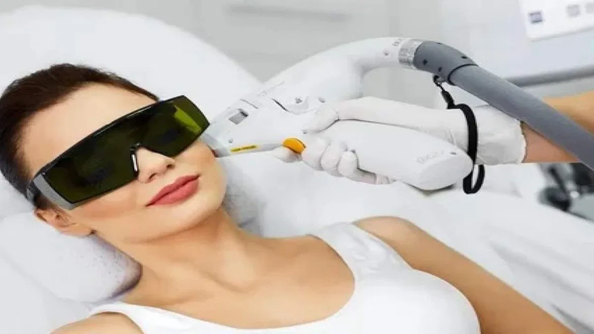 Yaz öncesi lazer epilasyon