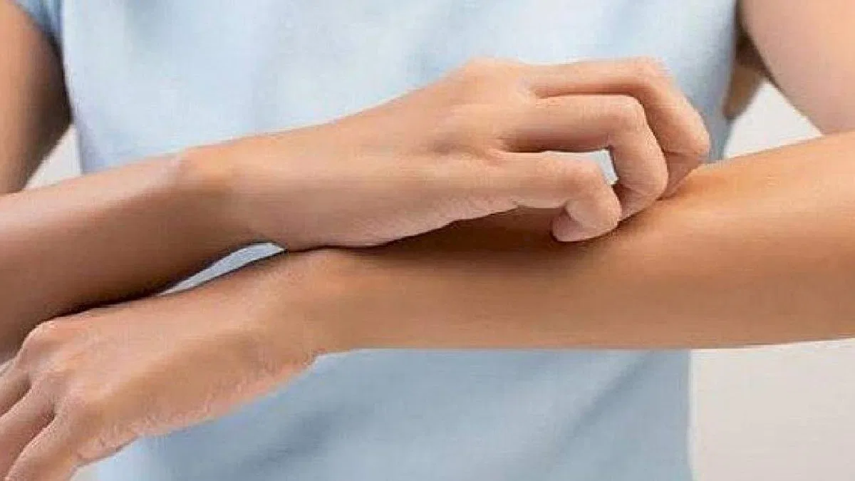 Uyuz vakalarında artış var, gözlerimizi nasıl korumalıyız?