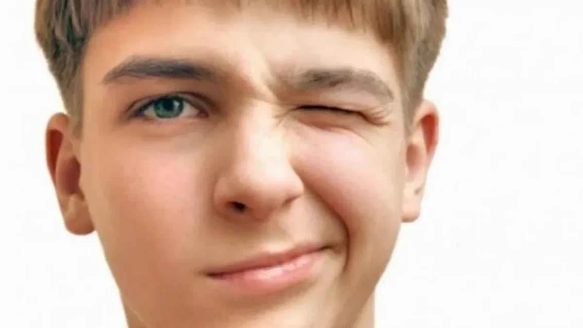 Tourette Sendromu Nedir? Belirtileri nelerdir?