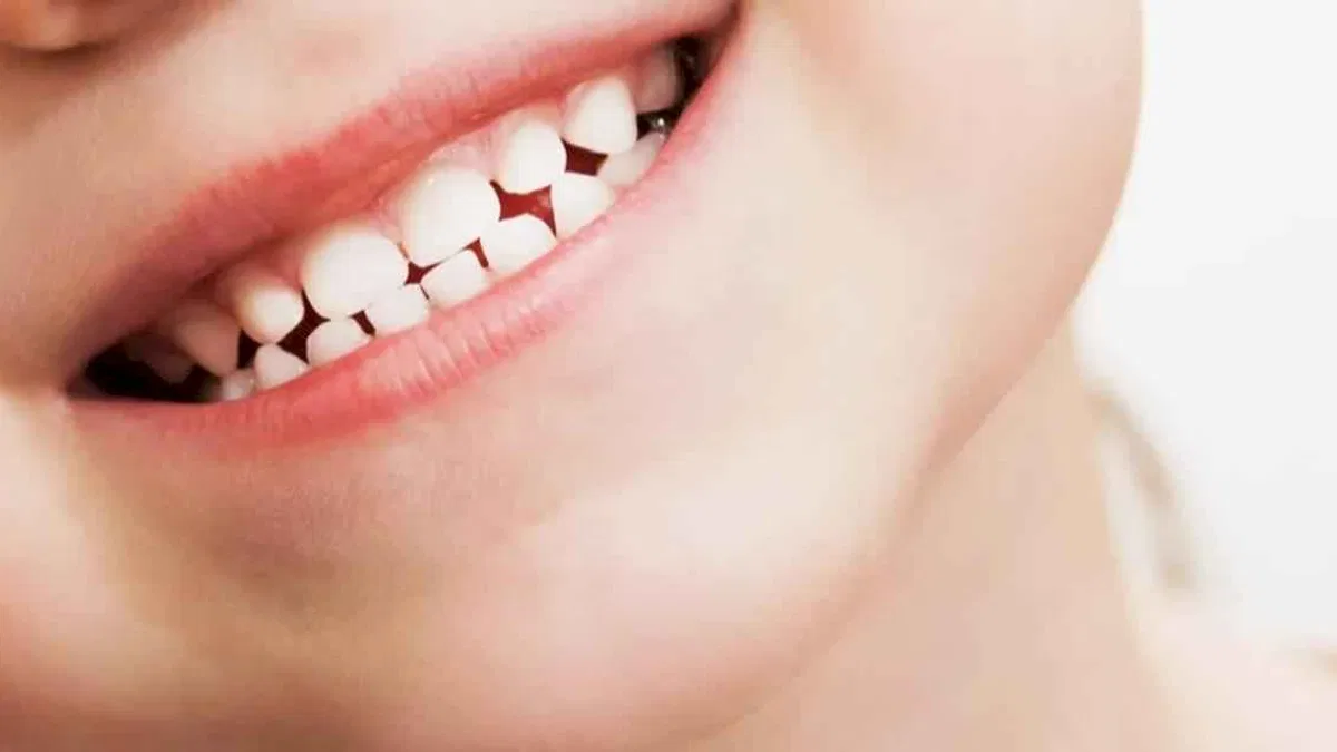 Diş sıkma alışkanlığı olan çocuklarda nelere dikkat edilmeli?