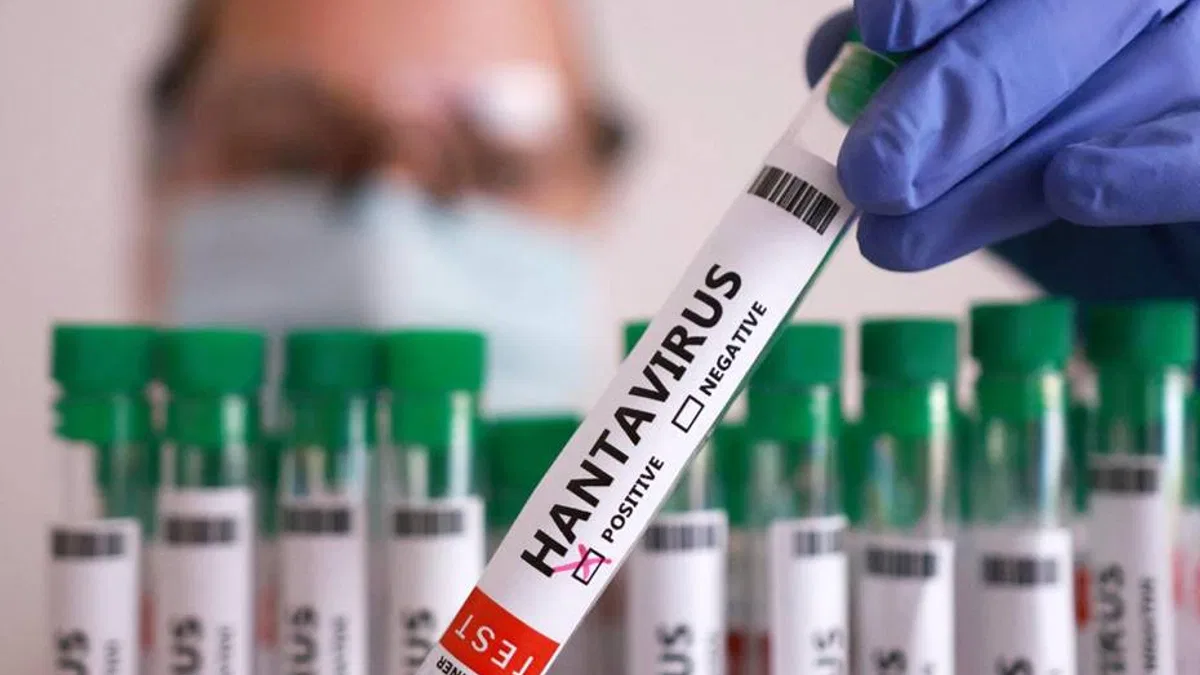 Hantavirüs açıklaması: Türkiye’de pozitif vaka yok!